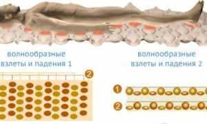 Противопролежневый матрас: какой лучше выбрать — ТОП 10