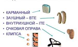 Какие слуховые аппараты лучше для пожилых людей — ТОП 11