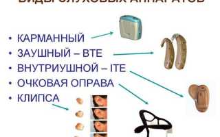 Какие слуховые аппараты лучше для пожилых людей — ТОП 11