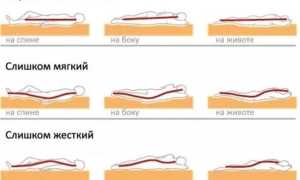 Как правильно выбрать ортопедический матрас для больной спины