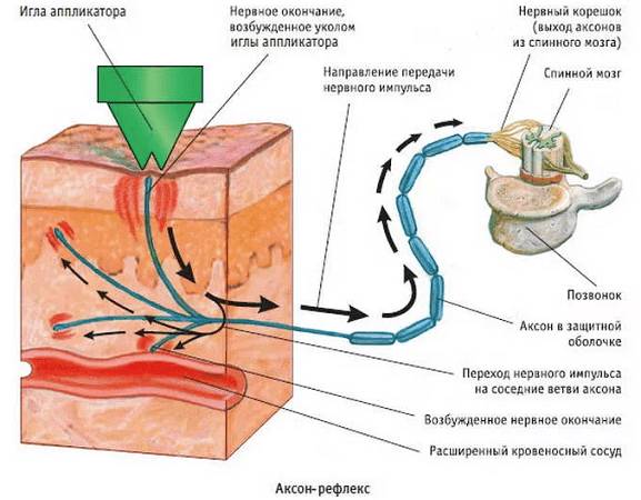 Какой аппликатор лучше Кузнецова или Ляпко - сравнение ковриков с шипами