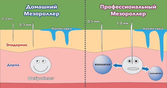 Какой мезороллер лучше выбрать для лица - Рейтинг лучших дермароллеров для дома
