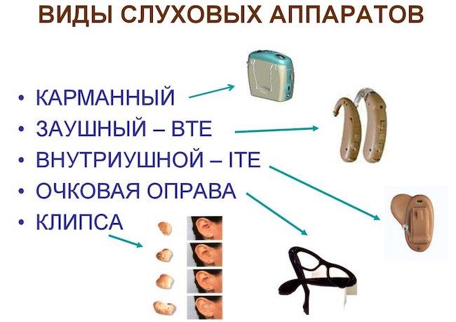 Какие слуховые аппараты лучше для пожилых людей - ТОП 11