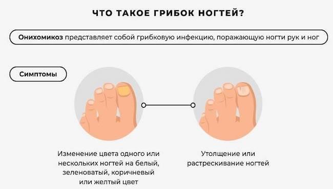 Эффективное средство от грибка ногтей на ногах - Рейтинг ТОП 12